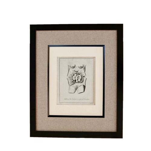 Antique Obstetrical Plate Triplets Print~P77584247